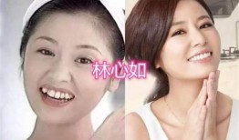 牙医爆料明星整牙视频